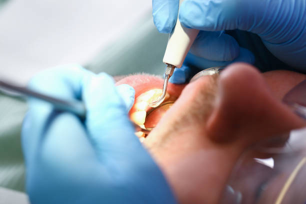 Best Pediatric Emergency Dentist in Westfield, PA