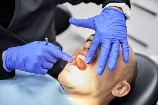 Best Urgent Care for Lost Fillings or Crowns in Westfield, PA